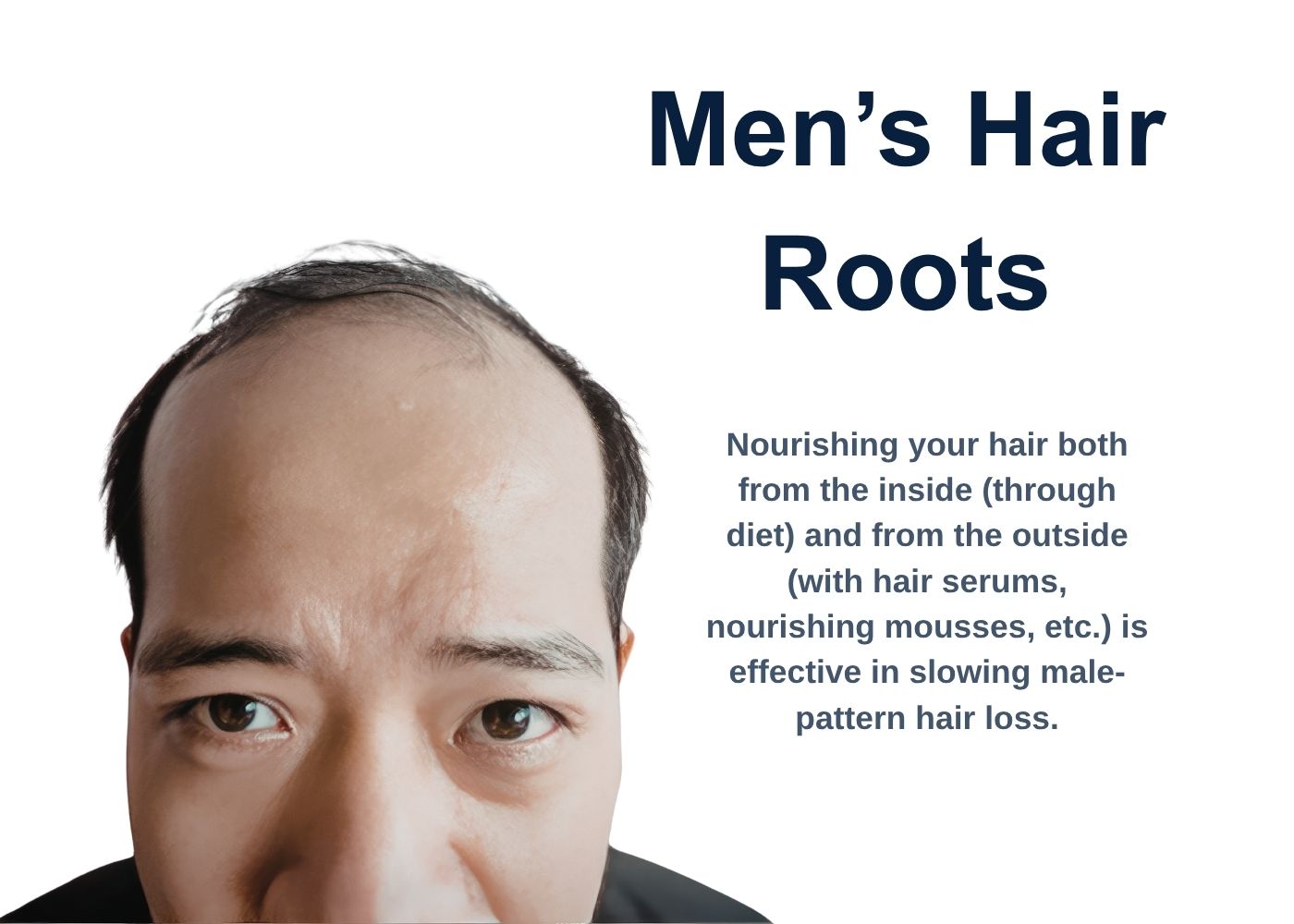 men hair roots