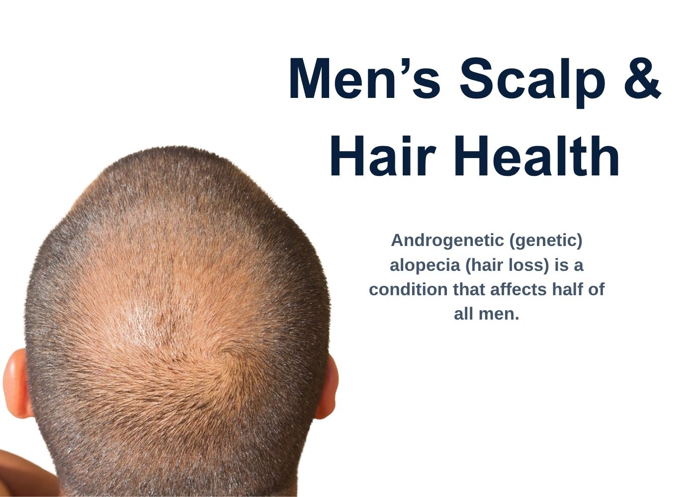 men's scalp health hair roots