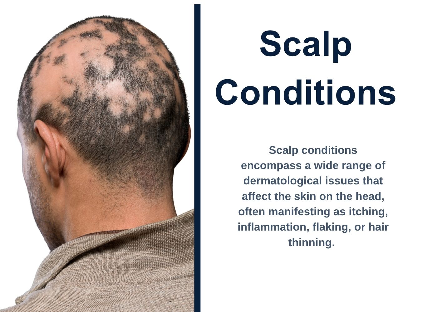 scalp conditions patchy bald